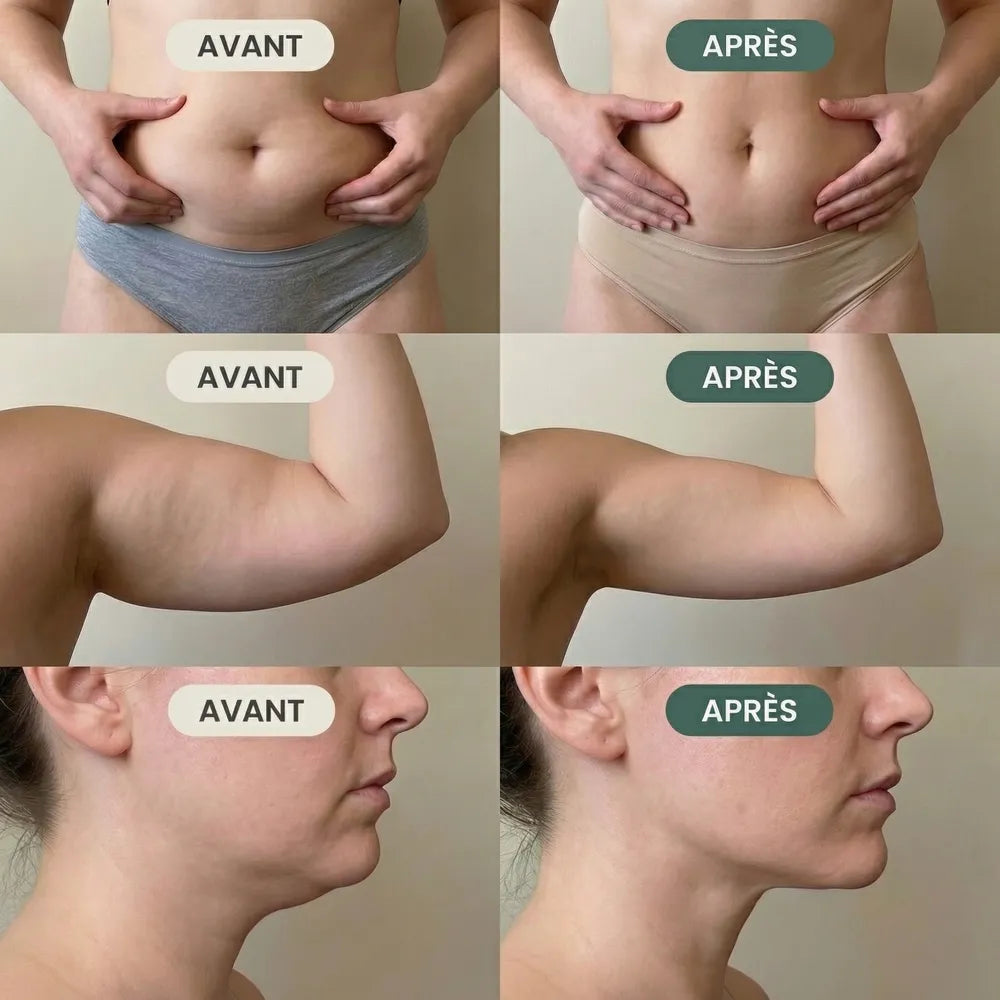 Lymora Drainant Lymphatique